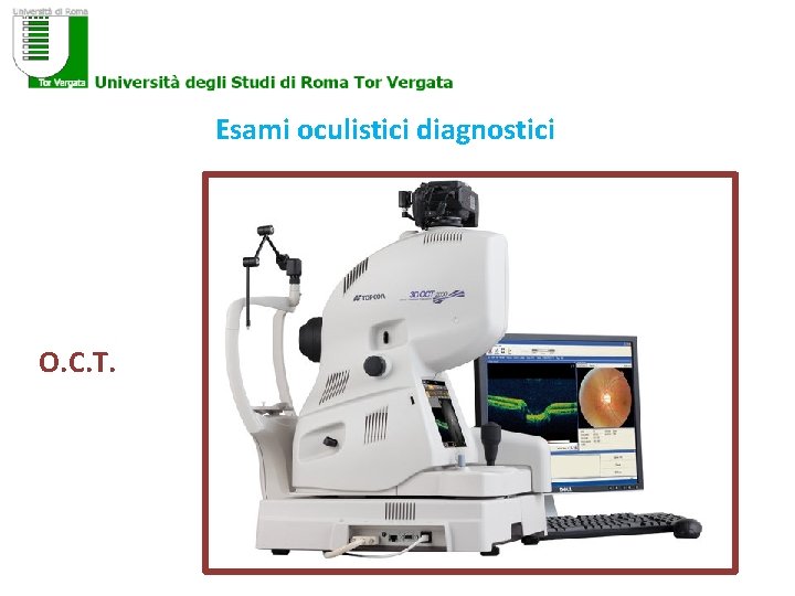 Esami oculistici diagnostici O. C. T. 