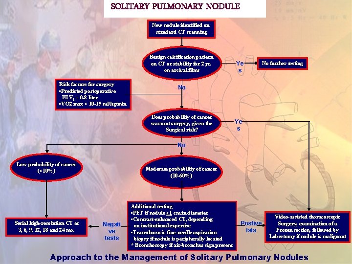 SOLITARY PULMONARY NODULE New nodule identified on standard CT scanning Benign calcification pattern on
