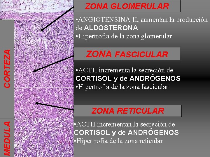ZONA GLOMERULAR CO RT E Z A • ANGIOTENSINA II, aumentan la producción de ZONA GLOMERULAR CO RT E Z A • ANGIOTENSINA II, aumentan la producción de