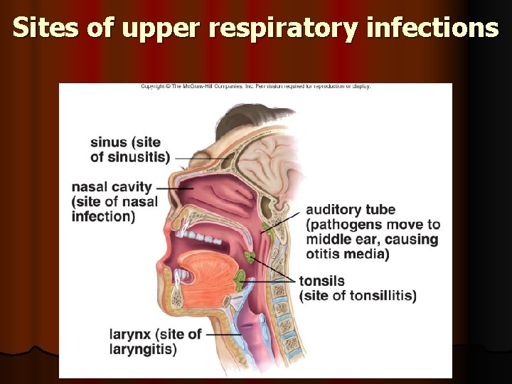 Sites of upper respiratory infections 