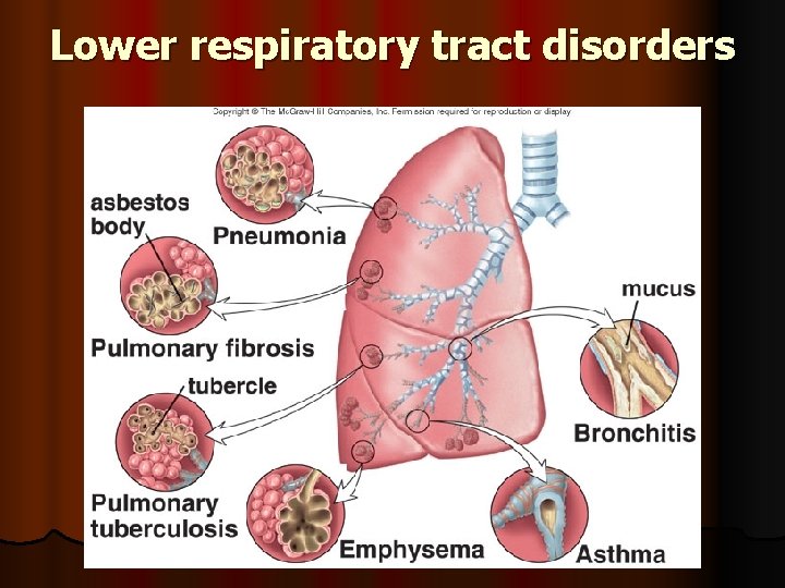 Lower respiratory tract disorders 