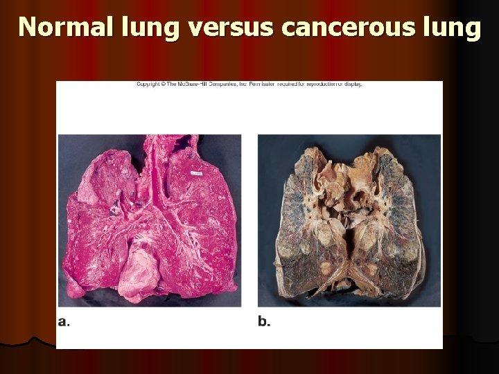 Normal lung versus cancerous lung 