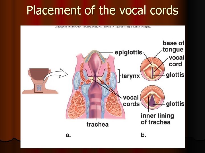 Placement of the vocal cords 