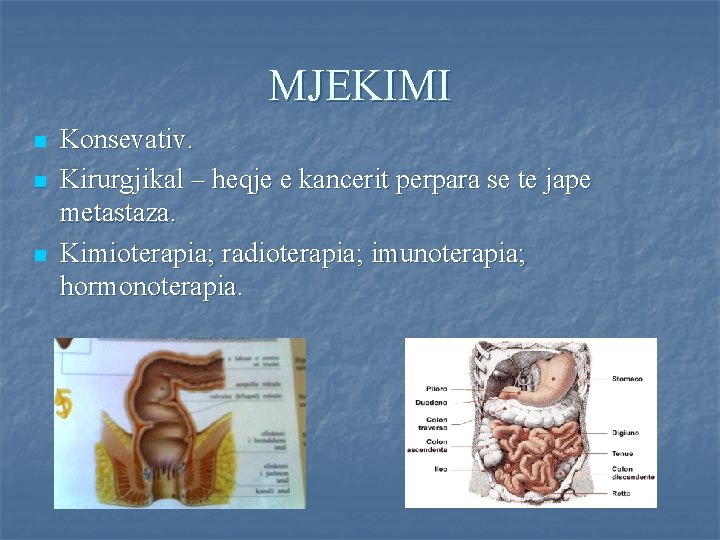 MJEKIMI n n n Konsevativ. Kirurgjikal – heqje e kancerit perpara se te jape