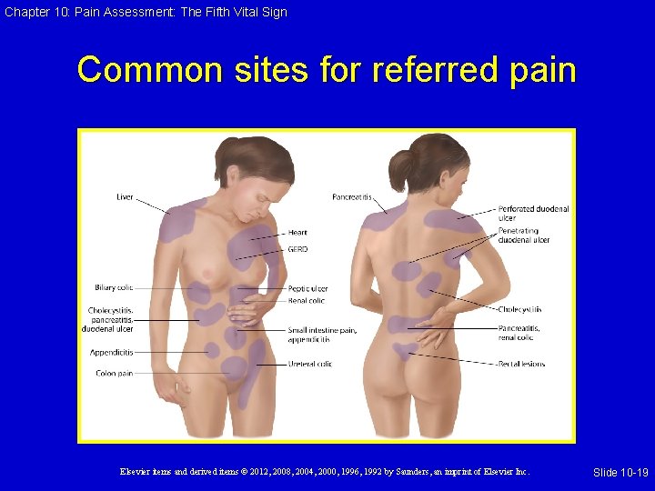 Chapter 10: Pain Assessment: The Fifth Vital Sign Common sites for referred pain Elsevier