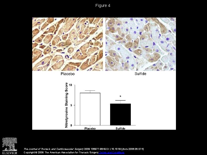 Figure 4 The Journal of Thoracic and Cardiovascular Surgery 2009 138977 -984 DOI: (10.