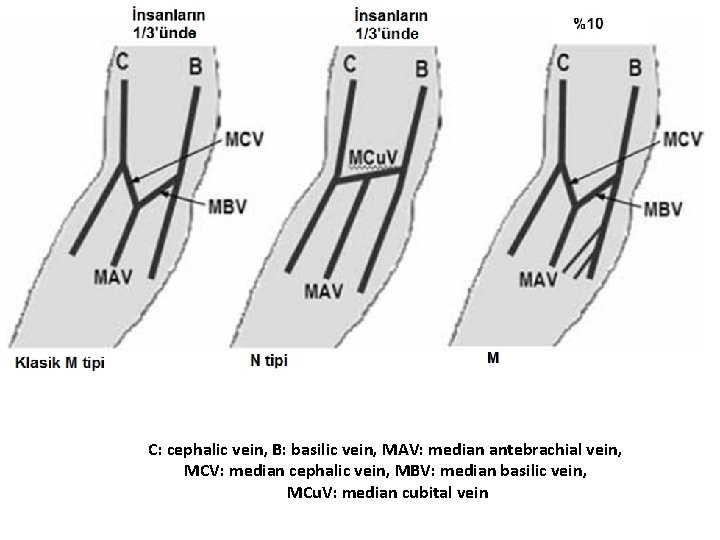 C: cephalic vein, B: basilic vein, MAV: median antebrachial vein, MCV: median cephalic vein, C: cephalic vein, B: basilic vein, MAV: median antebrachial vein, MCV: median cephalic vein,
