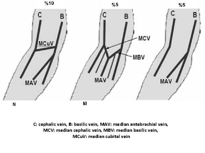 C: cephalic vein, B: basilic vein, MAV: median antebrachial vein, MCV: median cephalic vein,