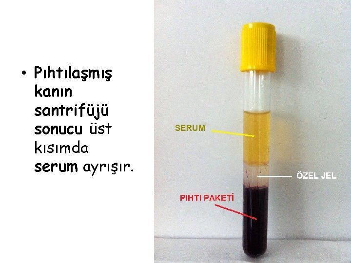  • Pıhtılaşmış kanın santrifüjü sonucu üst kısımda serum ayrışır. 