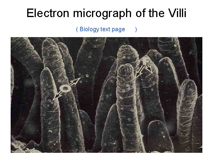 Electron micrograph of the Villi ( Biology text page ) 