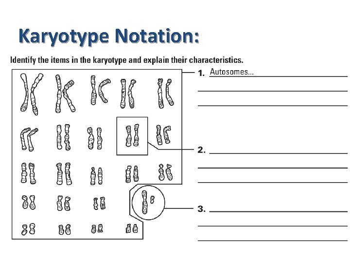 Karyotype Notation: 