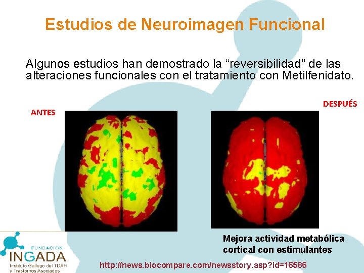 Estudios de Neuroimagen Funcional Algunos estudios han demostrado la “reversibilidad” de las alteraciones funcionales