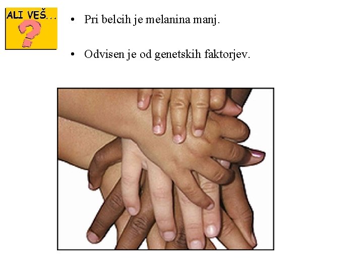  • Pri belcih je melanina manj. • Odvisen je od genetskih faktorjev. 