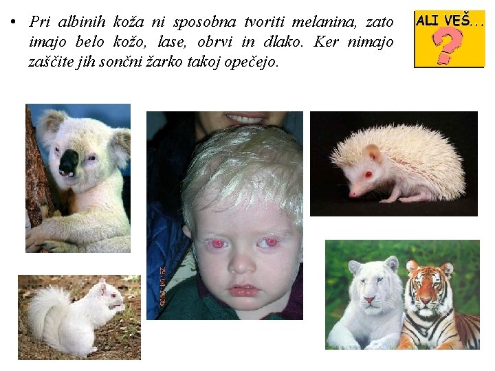  • Pri albinih koža ni sposobna tvoriti melanina, zato imajo belo kožo, lase,