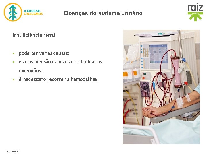 Doenças do sistema urinário Insuficiência renal § pode ter várias causas; § os rins