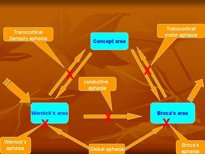 Transcortical motor aphasia Transcortical Sensory aphasia Concept area X Wernick’s aphasia X conductive aphasia