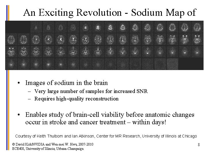 An Exciting Revolution - Sodium Map of the Brain • Images of sodium in