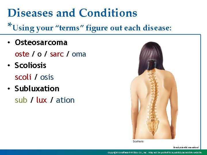 Diseases and Conditions *Using your “terms” figure out each disease: • Osteosarcoma oste /