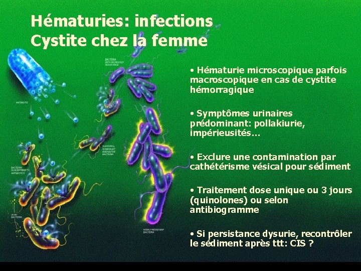 Hématuries: infections Cystite chez la femme • Hématurie microscopique parfois macroscopique en cas de