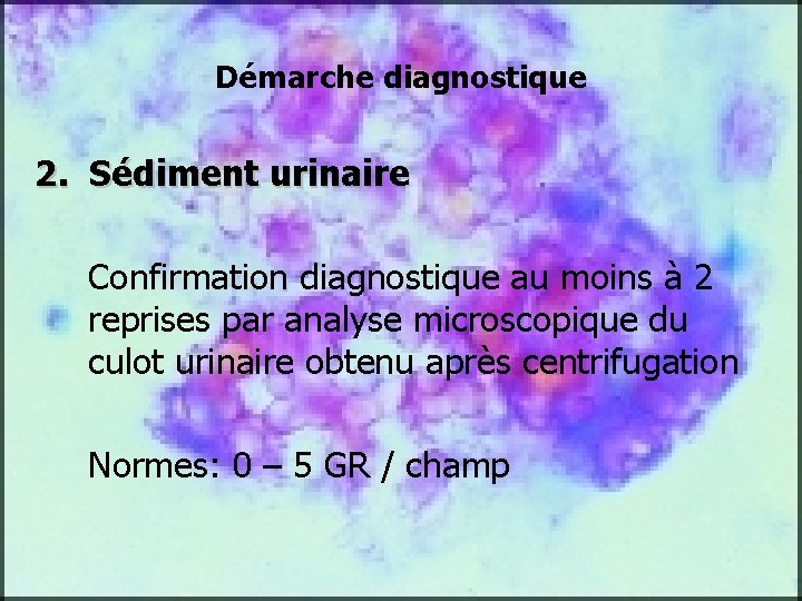 Démarche diagnostique 2. Sédiment urinaire Confirmation diagnostique au moins à 2 reprises par analyse