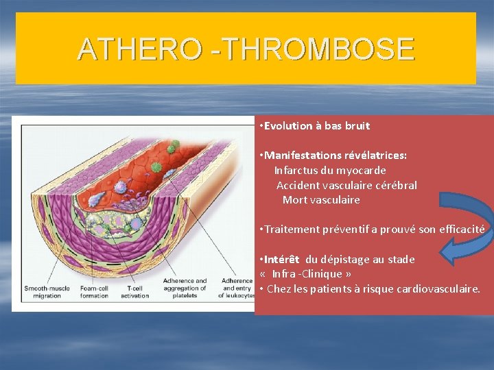 ATHERO -THROMBOSE • Evolution à bas bruit • Manifestations révélatrices: Infarctus du myocarde Accident