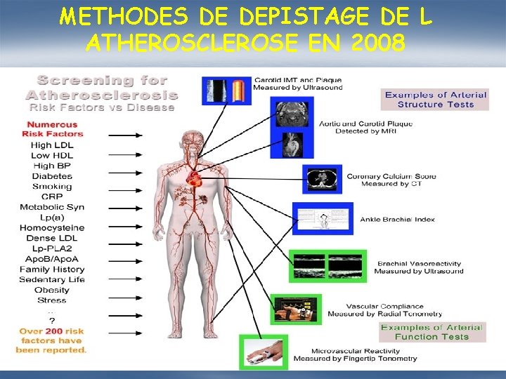 METHODES DE DEPISTAGE DE L ATHEROSCLEROSE EN 2008 