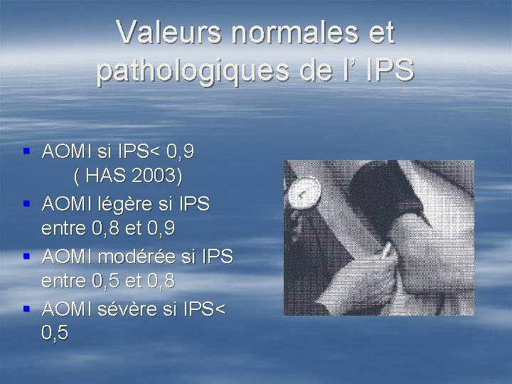 Valeurs normales et pathologiques de l’ IPS § AOMI si IPS< 0, 9 (
