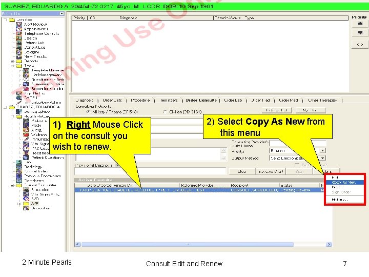 “Renewing” A Consult 1) Right Mouse Click on the consult you wish to renew.