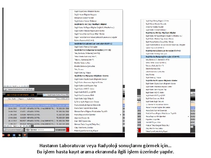 Hastanın Laboratuvar veya Radyoloji sonuçlarını görmek için… Bu işlem hasta kayıt arama ekranında ilgili