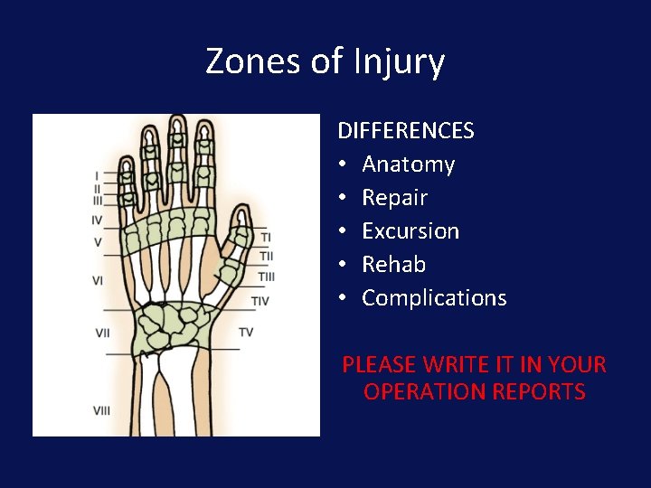 Zones of Injury DIFFERENCES • Anatomy • Repair • Excursion • Rehab • Complications