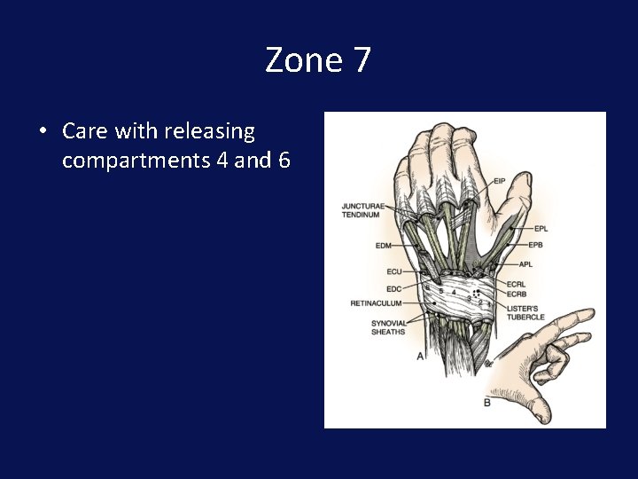 Zone 7 • Care with releasing compartments 4 and 6 