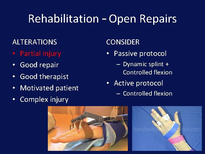 Rehabilitation – Open Repairs ALTERATIONS • Partial injury • Good repair • Good therapist