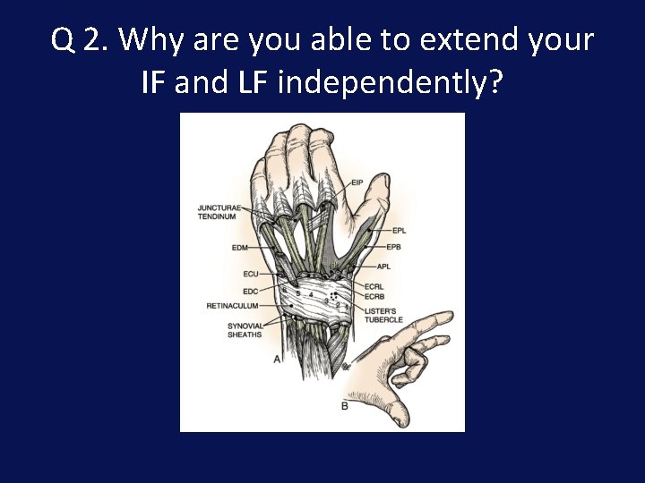 Q 2. Why are you able to extend your IF and LF independently? 