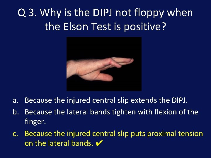 Q 3. Why is the DIPJ not floppy when the Elson Test is positive?
