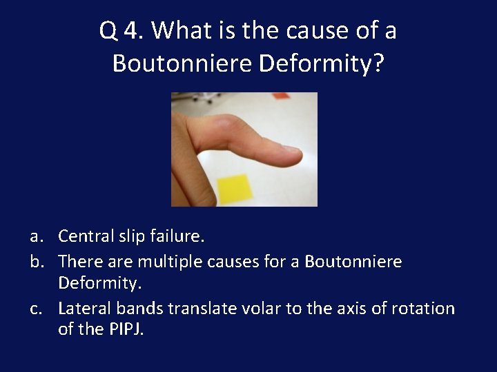Q 4. What is the cause of a Boutonniere Deformity? a. Central slip failure.