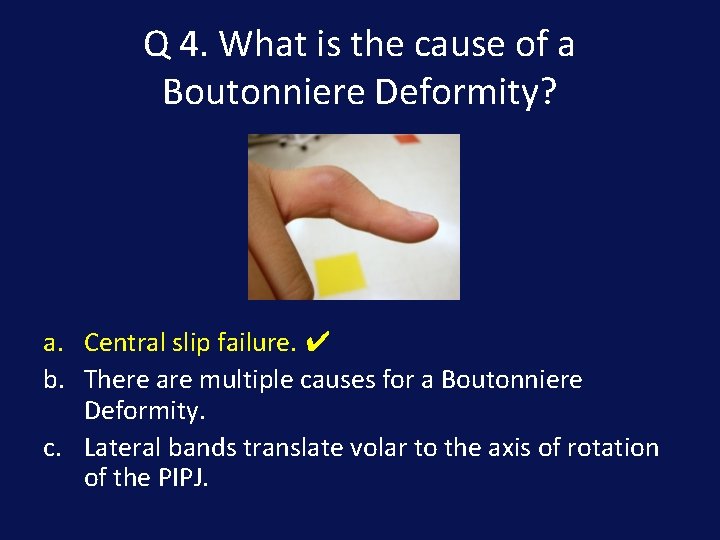 Q 4. What is the cause of a Boutonniere Deformity? a. Central slip failure.