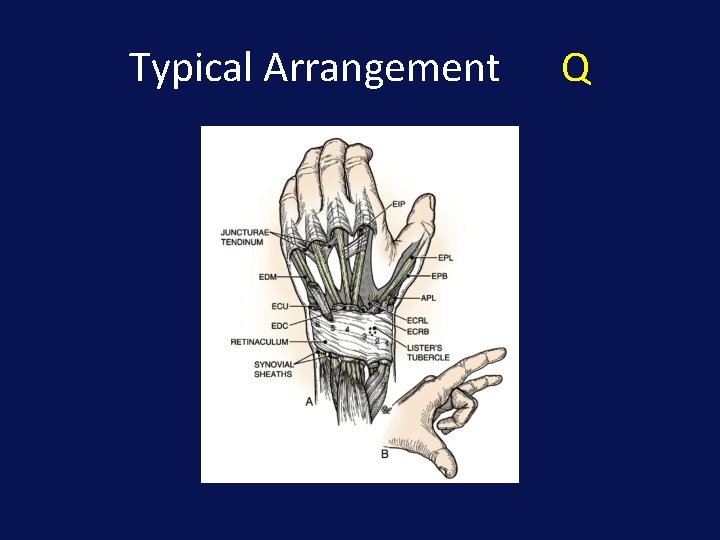Typical Arrangement Q 
