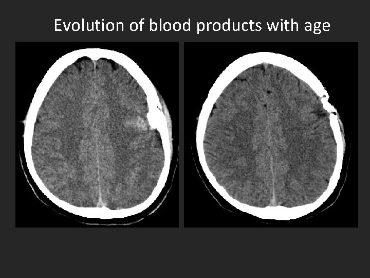 Evolution of blood products with age 