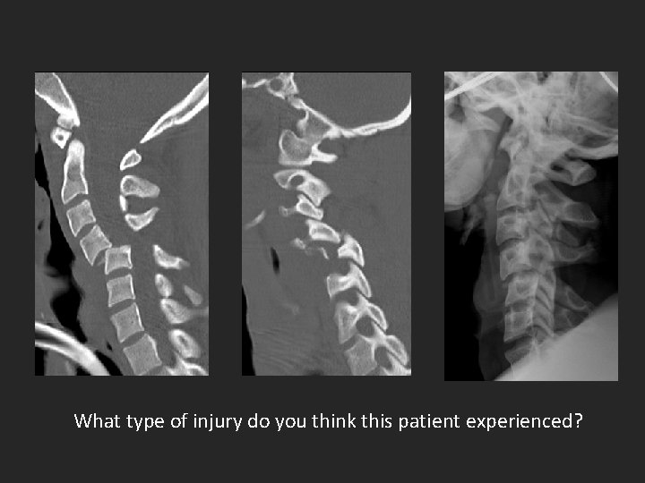 What type of injury do you think this patient experienced? 