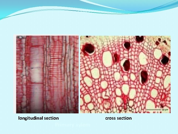 longitudinal section Primary xylem cross section 