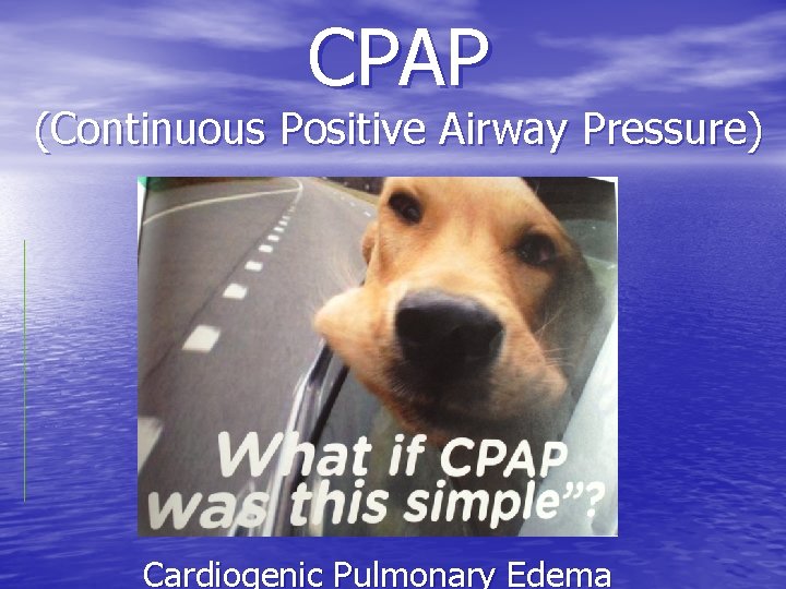 CPAP (Continuous Positive Airway Pressure) Cardiogenic Pulmonary Edema 