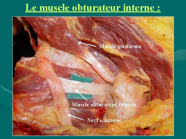 Le muscle obturateur interne : 