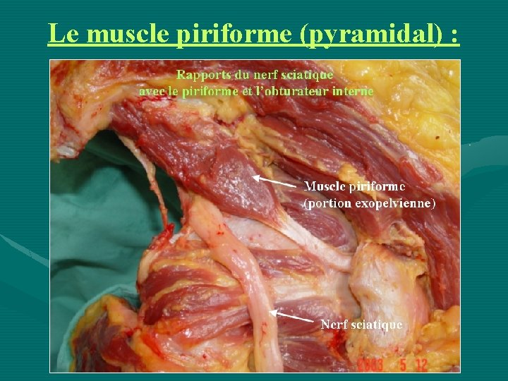 Le muscle piriforme (pyramidal) : 