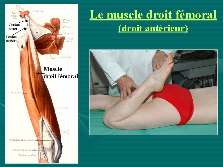 Le muscle droit fémoral (droit antérieur) 