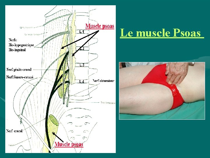 Le muscle Psoas 