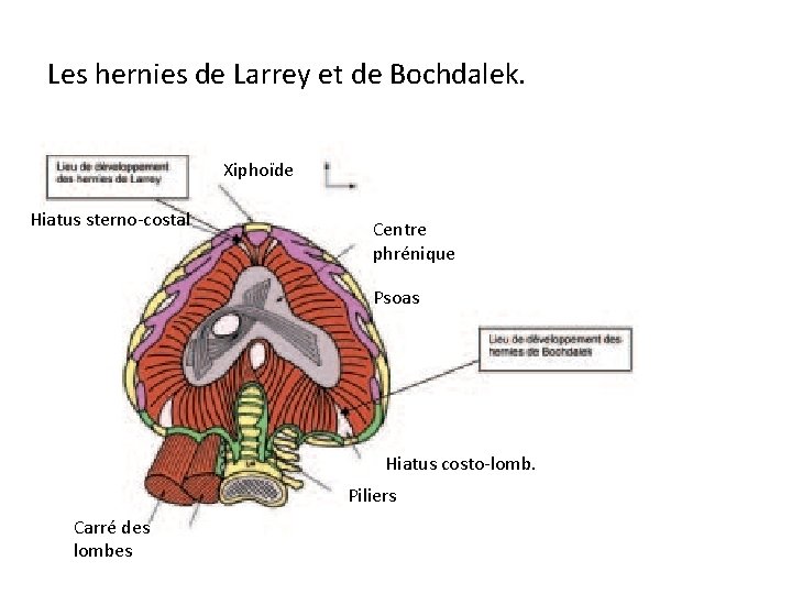 Les hernies de Larrey et de Bochdalek. Xiphoïde Hiatus sterno costal Centre phrénique Psoas