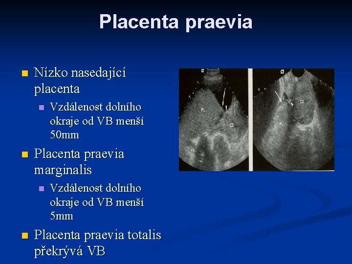 Placenta praevia n Nízko nasedající placenta n n Placenta praevia marginalis n n Vzdálenost