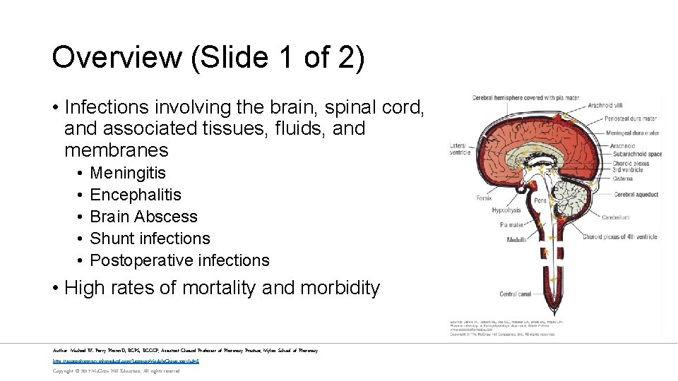 Overview (Slide 1 of 2) • Infections involving the brain, spinal cord, and associated
