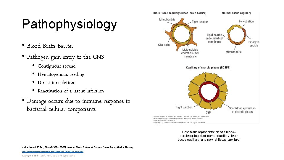 Pathophysiology • Blood Brain Barrier • Pathogen gain entry to the CNS • •
