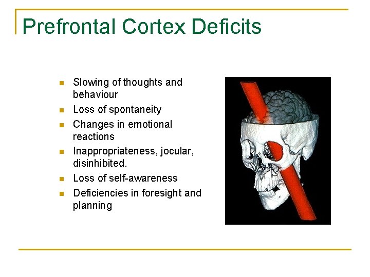 Prefrontal Cortex Deficits n n n Slowing of thoughts and behaviour Loss of spontaneity